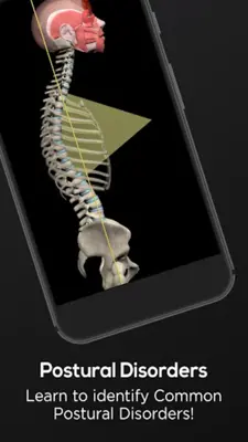 Posture by Muscle & Motion android App screenshot 12