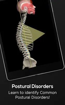 Posture by Muscle & Motion android App screenshot 4