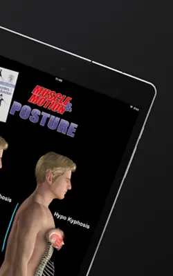 Posture by Muscle & Motion android App screenshot 6